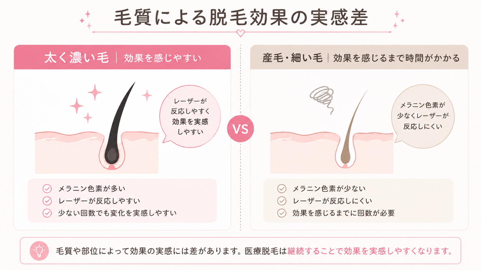 毛質による脱毛効果の実感差（太く濃い毛と産毛の比較）